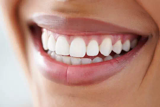 What exactly is aesthetic dentistry