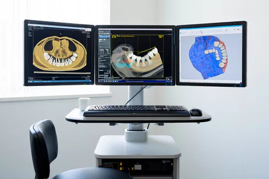 Are implants my teeth